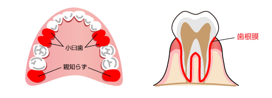 抜歯した歯を保存します。