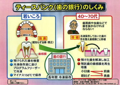 ティースバンクク(歯の銀行)